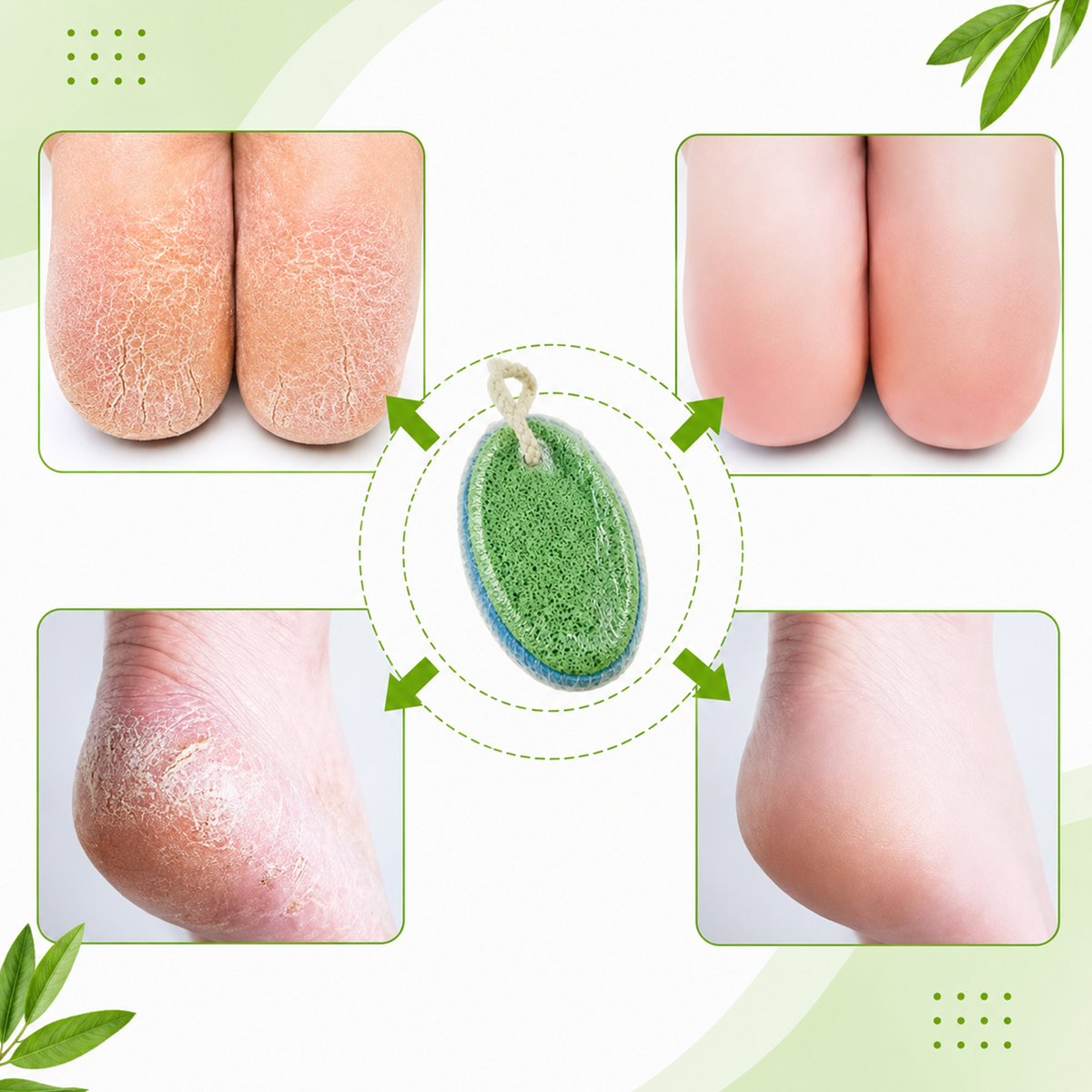 Foot Pumice Stone for Dead Skin Removal - 3.54 Inch Oval Foot Scrubber and Massager, Lightweight Exfoliating Tool for Smooth, Soft Feet, Pedicure Care for Heels and Calluses (Pack of 2)